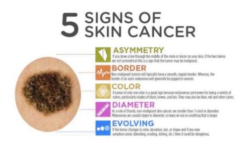 Skin Cancer Facts and Stats